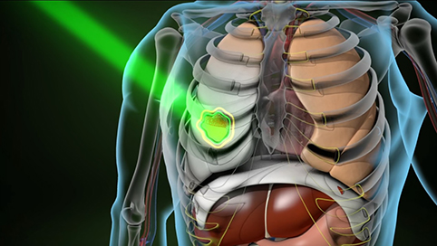 precise-radiation-video-call-out-image