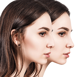 What is Cosmetic Surgery of the Nose?