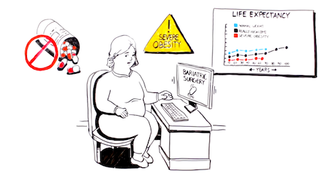 Bariatric surgery videos