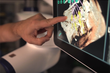 precision robotic surgery