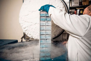 doctor freezing cancer research samples