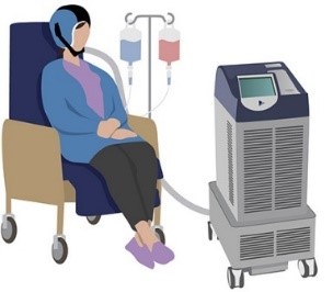 machine scalp cooling illustration