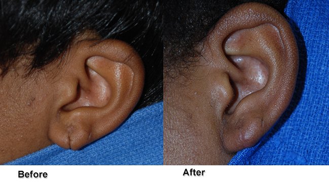 jones earrevision 1