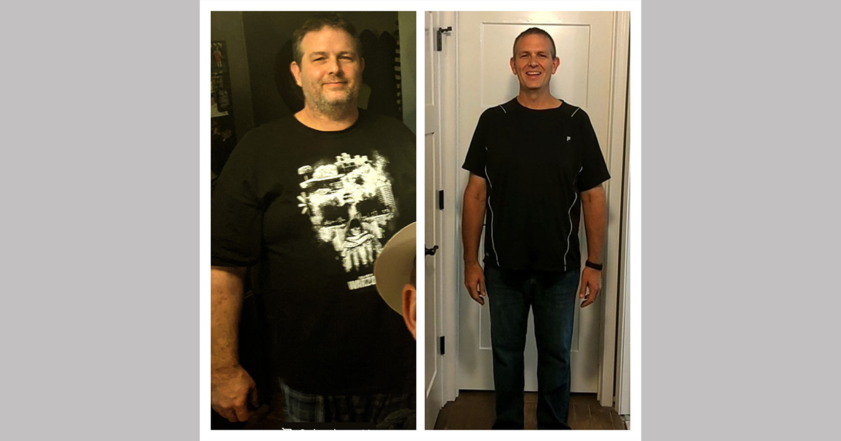 Mike's Story, Weight Loss Patient Stories