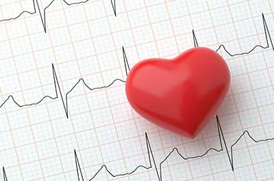 do I have AFib Symptoms