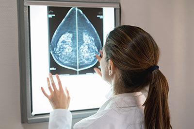 dense breasts on mammogram