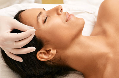 cosmetic acupuncture