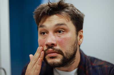 eczema skin conditions