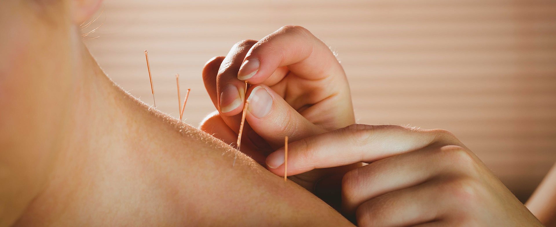 acupuncture for women