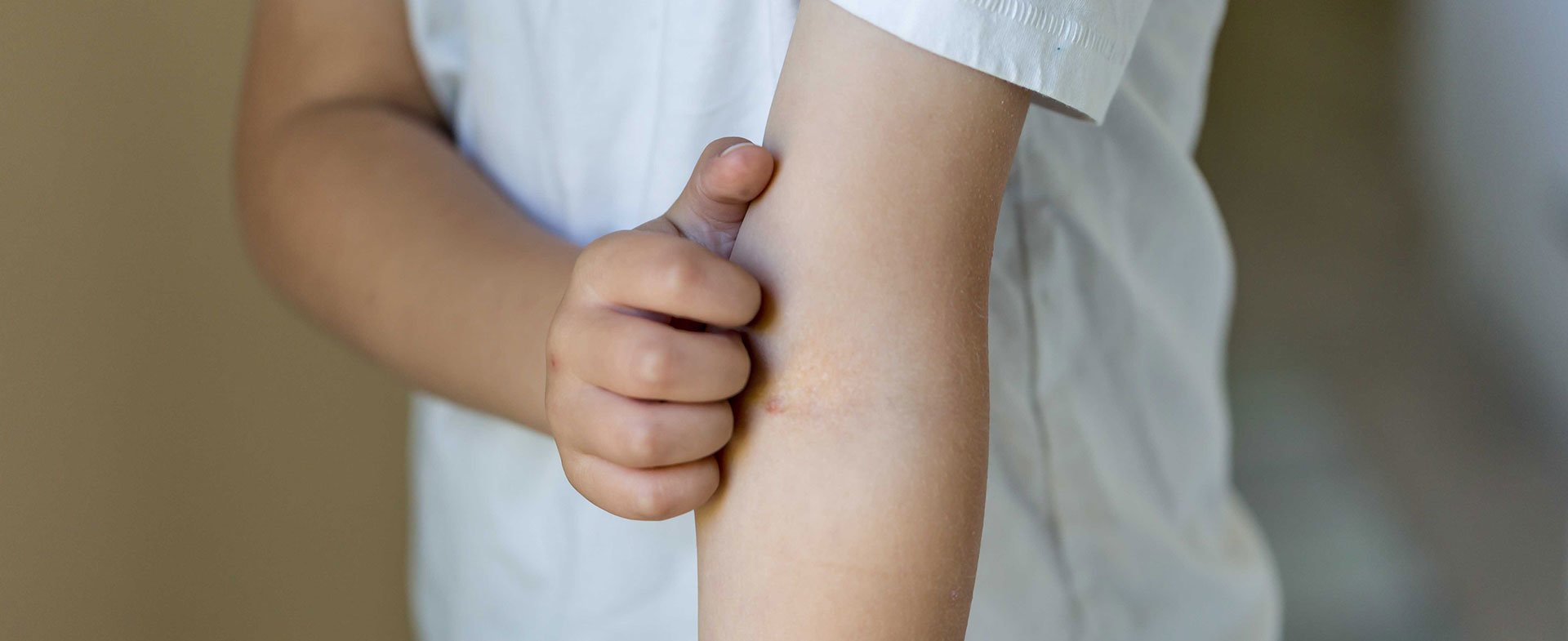 child itching eczema