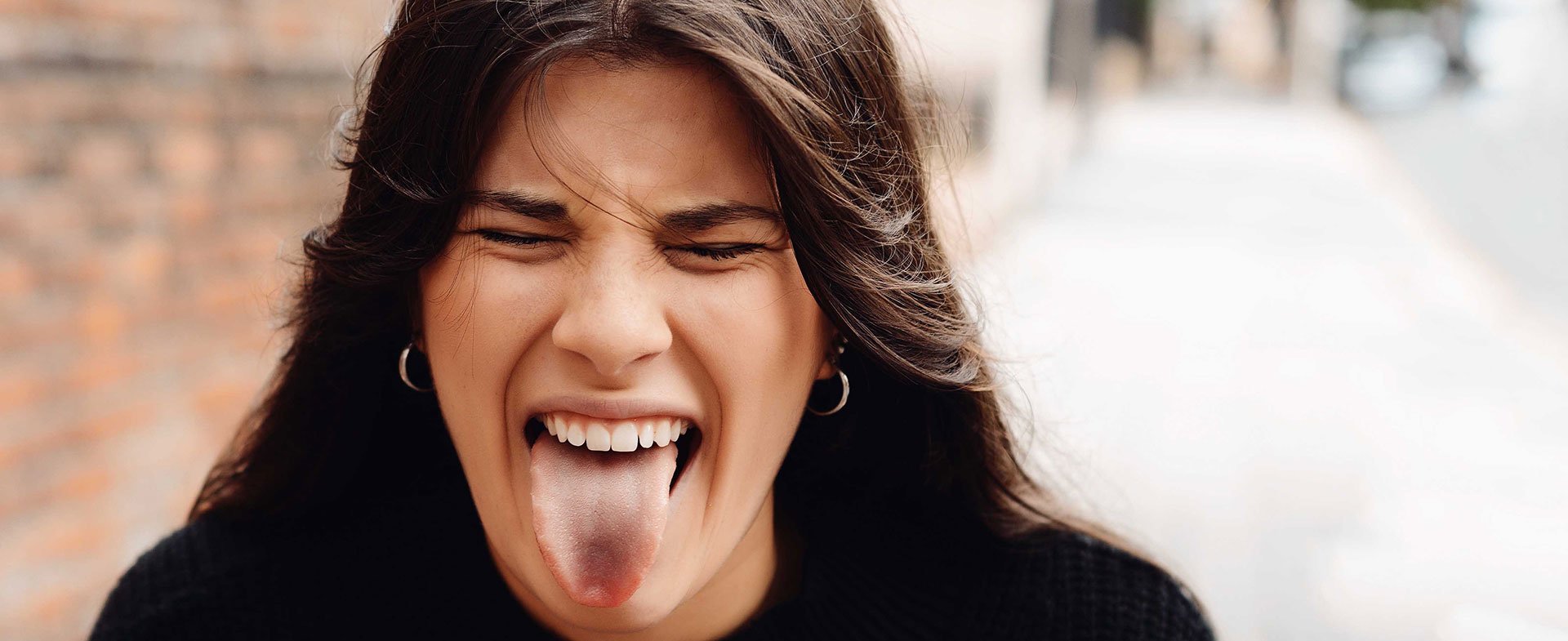 tongue discoloration