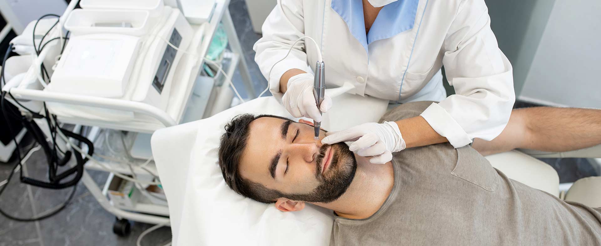 microneedling