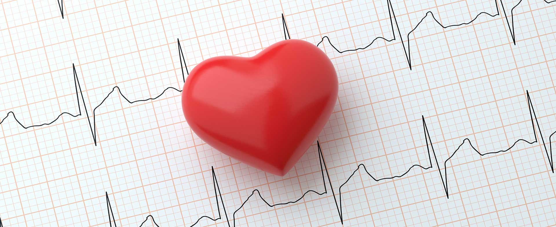 Do I have AFIb symptoms