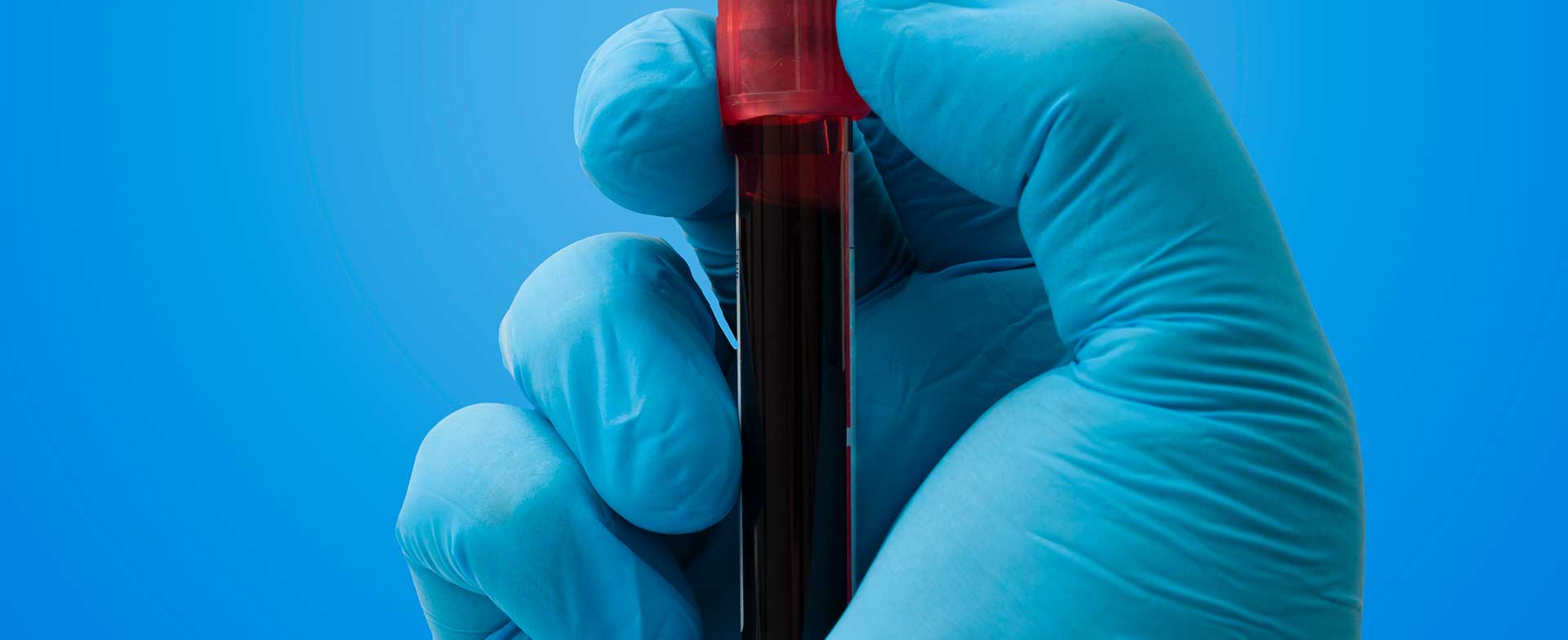 Blood test
