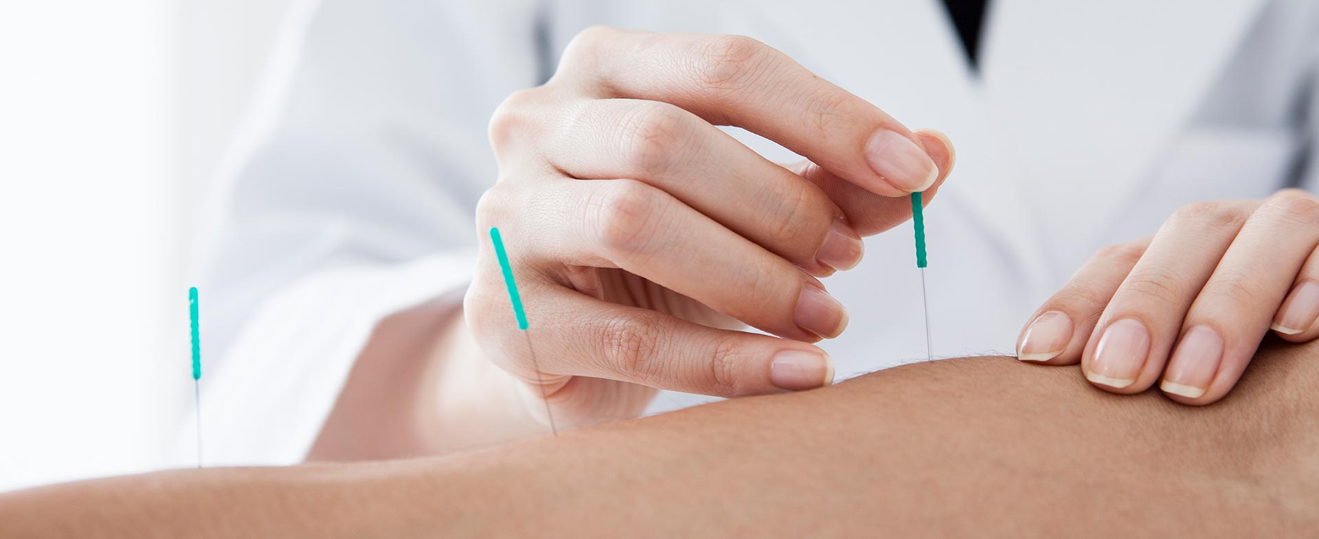 Have Tennis Or Golfer's Elbow? Sports Acupuncture May Help Henry Ford