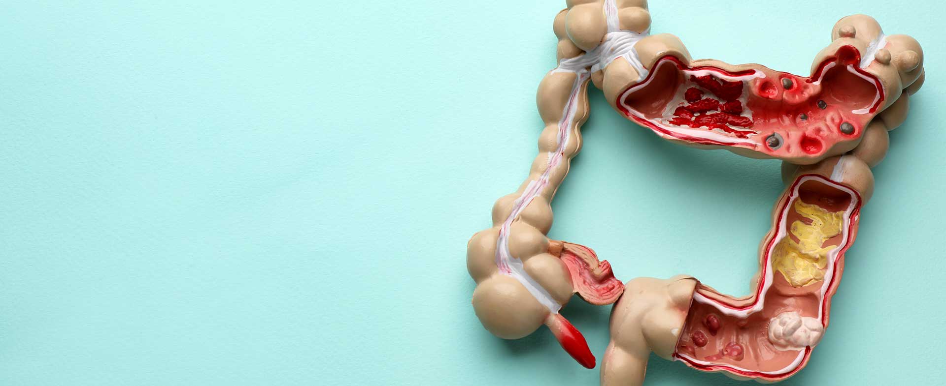 model of colon
