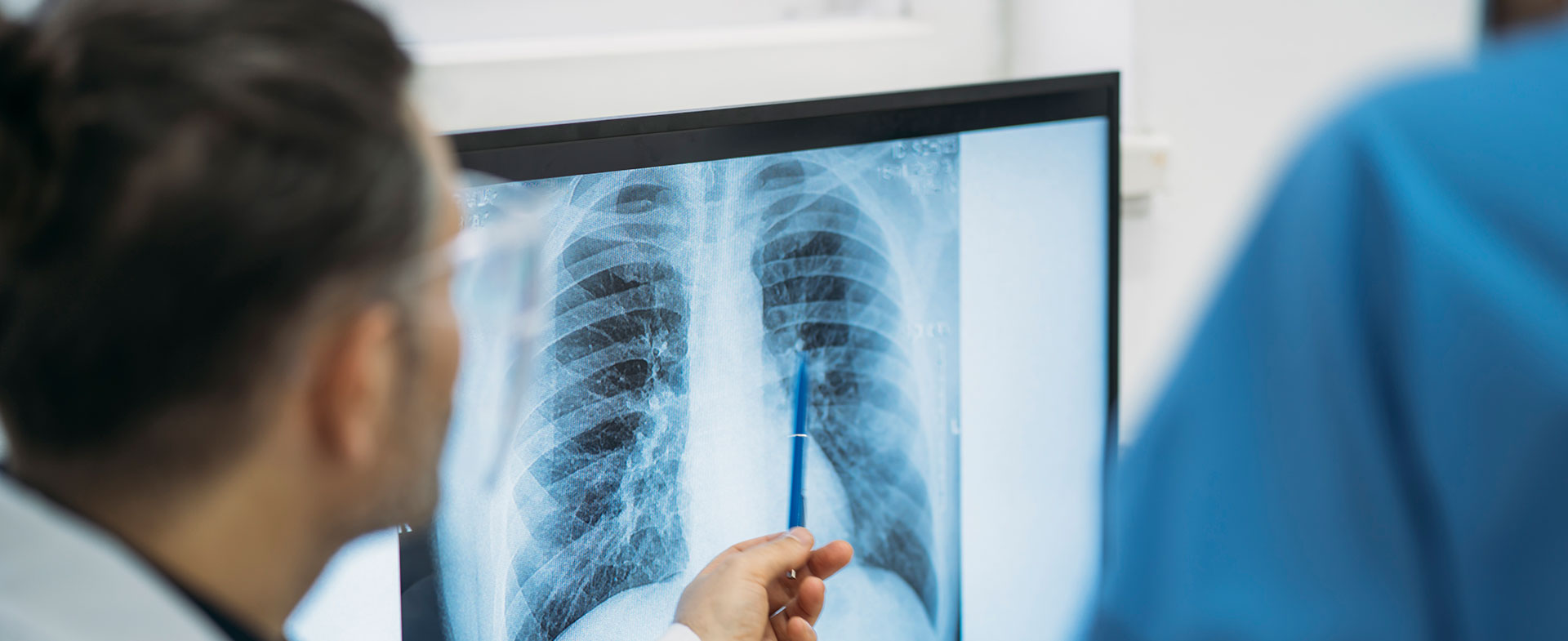 pulmonary embolism
