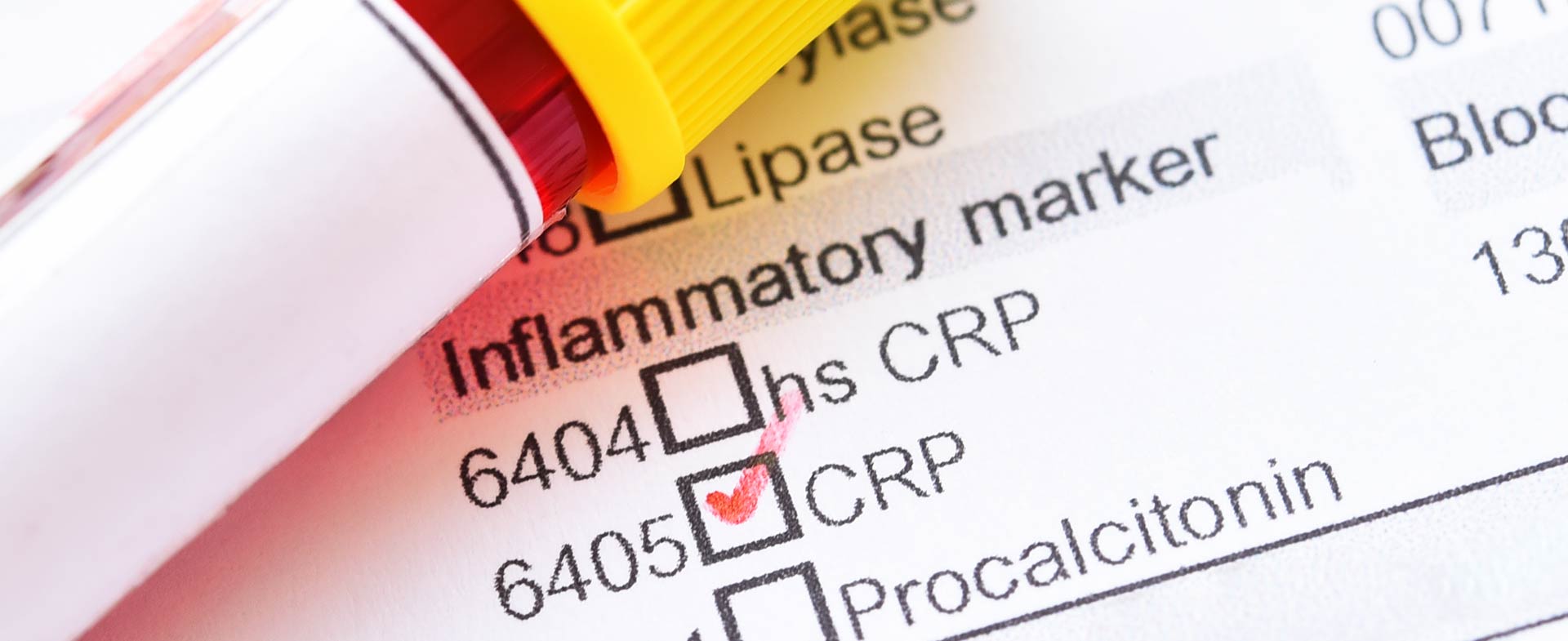 crp and heart health