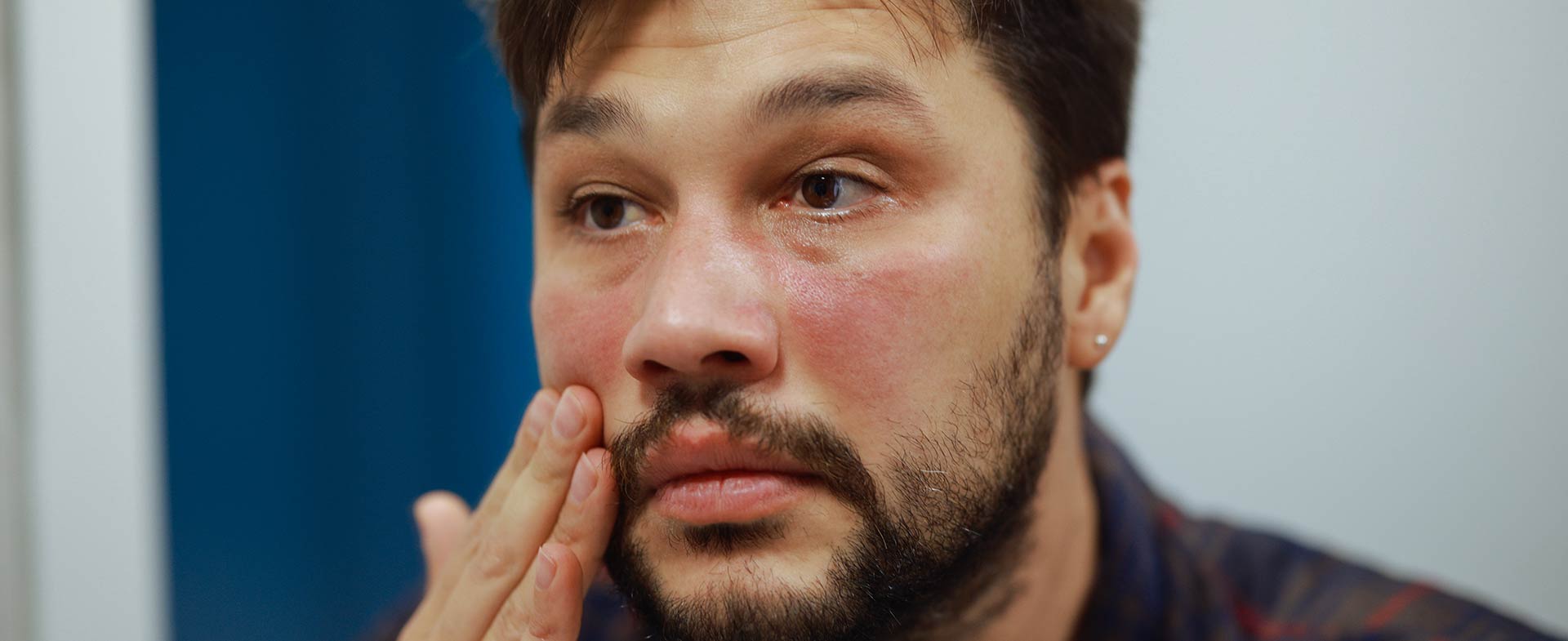A person with a beard touches their cheek, appearing to have red, irritated skin. The background includes a blue wall and a white door. eczema skin conditions