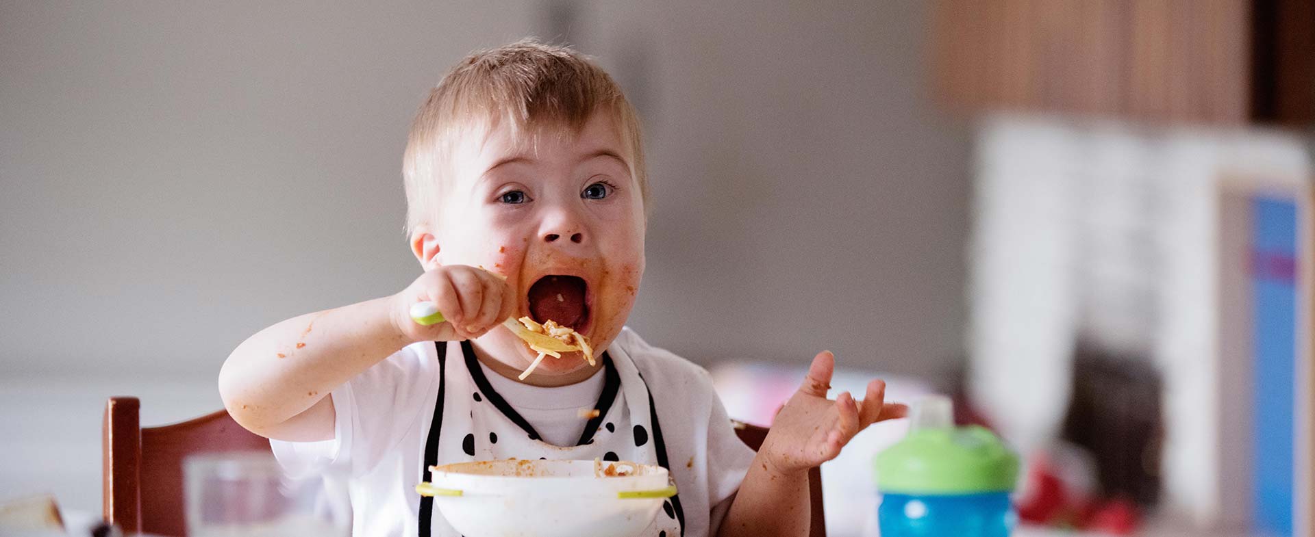 eating challenges down syndrome