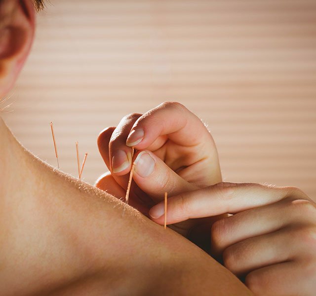acupuncture for women