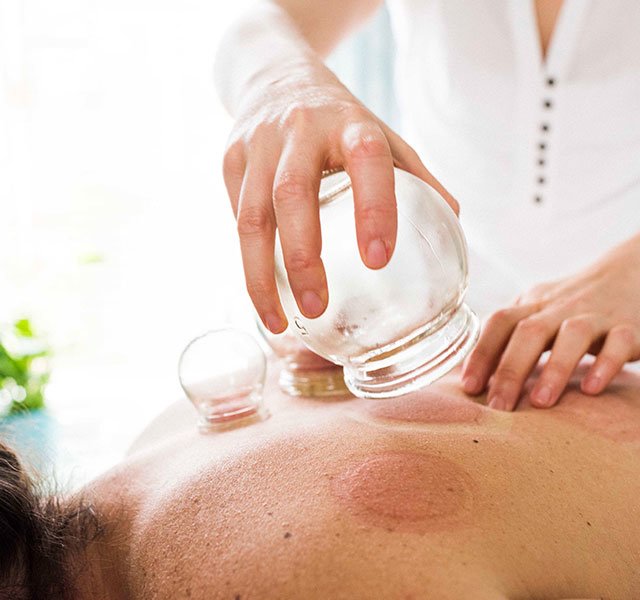 woman cupping patients back