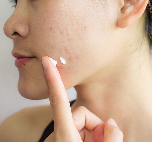 skincare dos donts