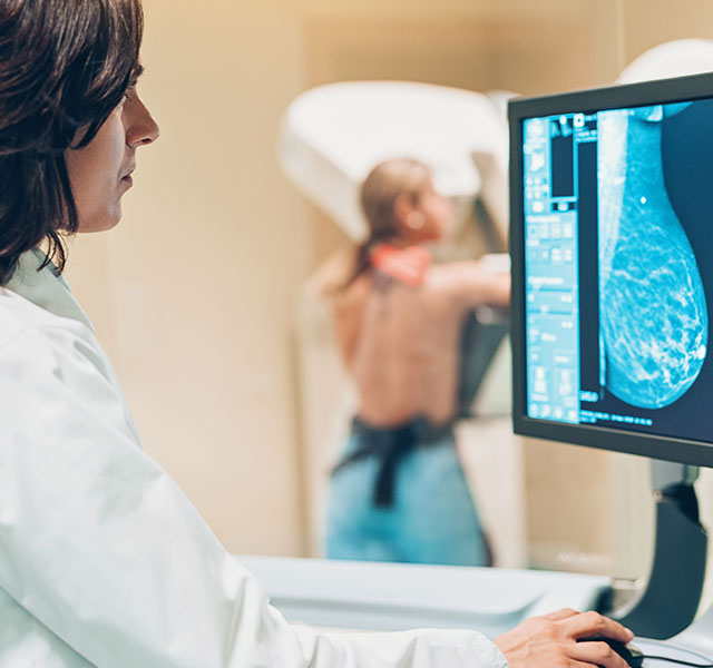 breast cancer screening