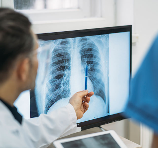 pulmonary embolism