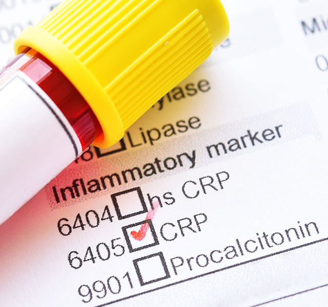 crp and heart health