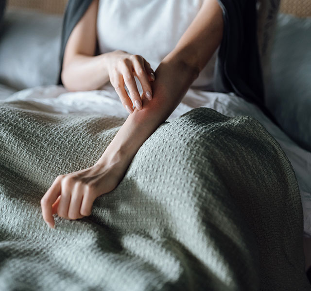 A person resting in bed gently touches their forearm, which shows a red rash. The bed is covered with a textured green blanket. hives