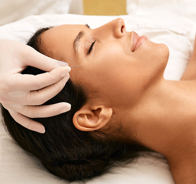cosmetic acupuncture