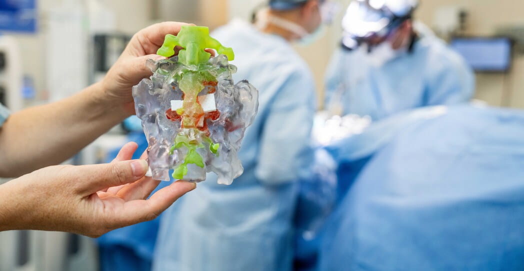 First in World Procedure was Planned using 3D Printed Model