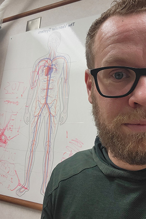 vascular patient Eric taking a selfie with heart diagram
