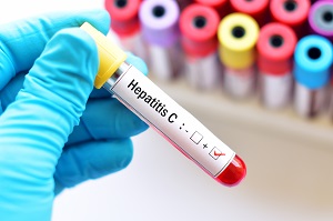 hep c consult